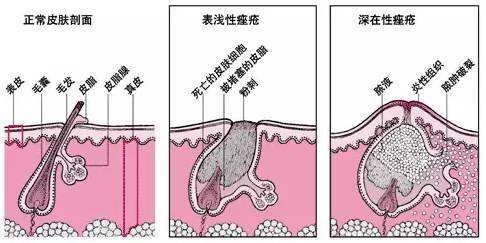 治療痤瘡的最好醫(yī)院,治療痤瘡的最好醫(yī)院，系統(tǒng)化分析與說明,科學(xué)解答解釋定義_進(jìn)階版18.44.30