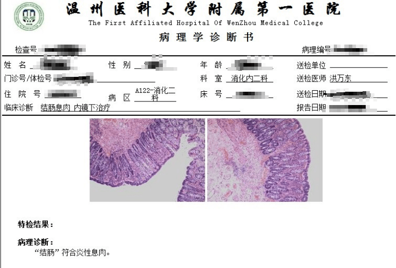 慢性附件炎會(huì)癌變嗎,關(guān)于慢性附件炎與癌變風(fēng)險(xiǎn)及高速響應(yīng)方案解析的文章,理論研究解析說(shuō)明_珂羅版44.46.33