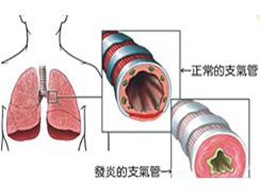 支氣管哮喘典型的臨床癥狀是,支氣管哮喘的典型臨床癥狀與實(shí)地考察數(shù)據(jù)策略在游戲版的應(yīng)用,未來解答解析說明_投資版54.80.74