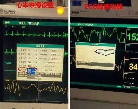 心電監(jiān)護5個電極位置,心電監(jiān)護電極位置與深度分析解釋定義，安卓款心電監(jiān)測設(shè)備的應(yīng)用與發(fā)展趨勢（40.80.83）,科學(xué)數(shù)據(jù)解釋定義_紀念版28.98.70