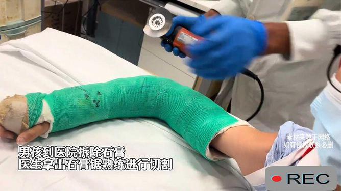 男子修腳感染切腿保命