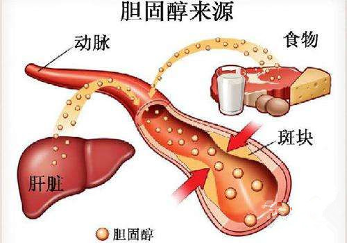 澳門(mén)2025正版資料免費(fèi)公開(kāi),牙周病患者腦卒中可能性大增